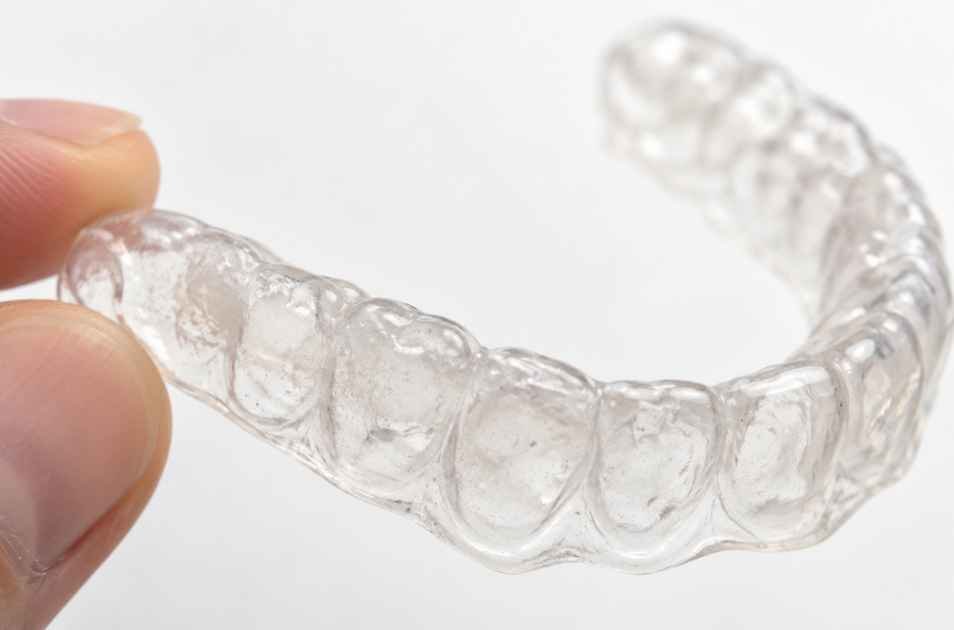 How to Remove White Buildup From a Retainer (And Why It’s Cloudy)